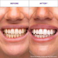 Whilux Toothpaste Foam™