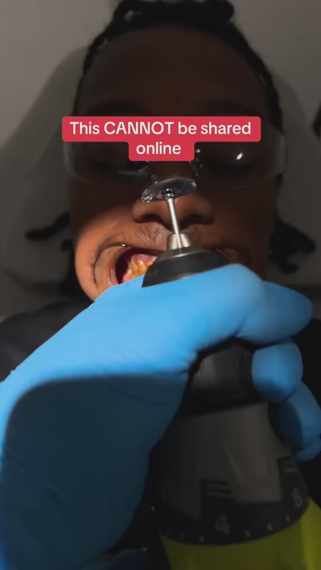 Whilux Whitening Strips™ video