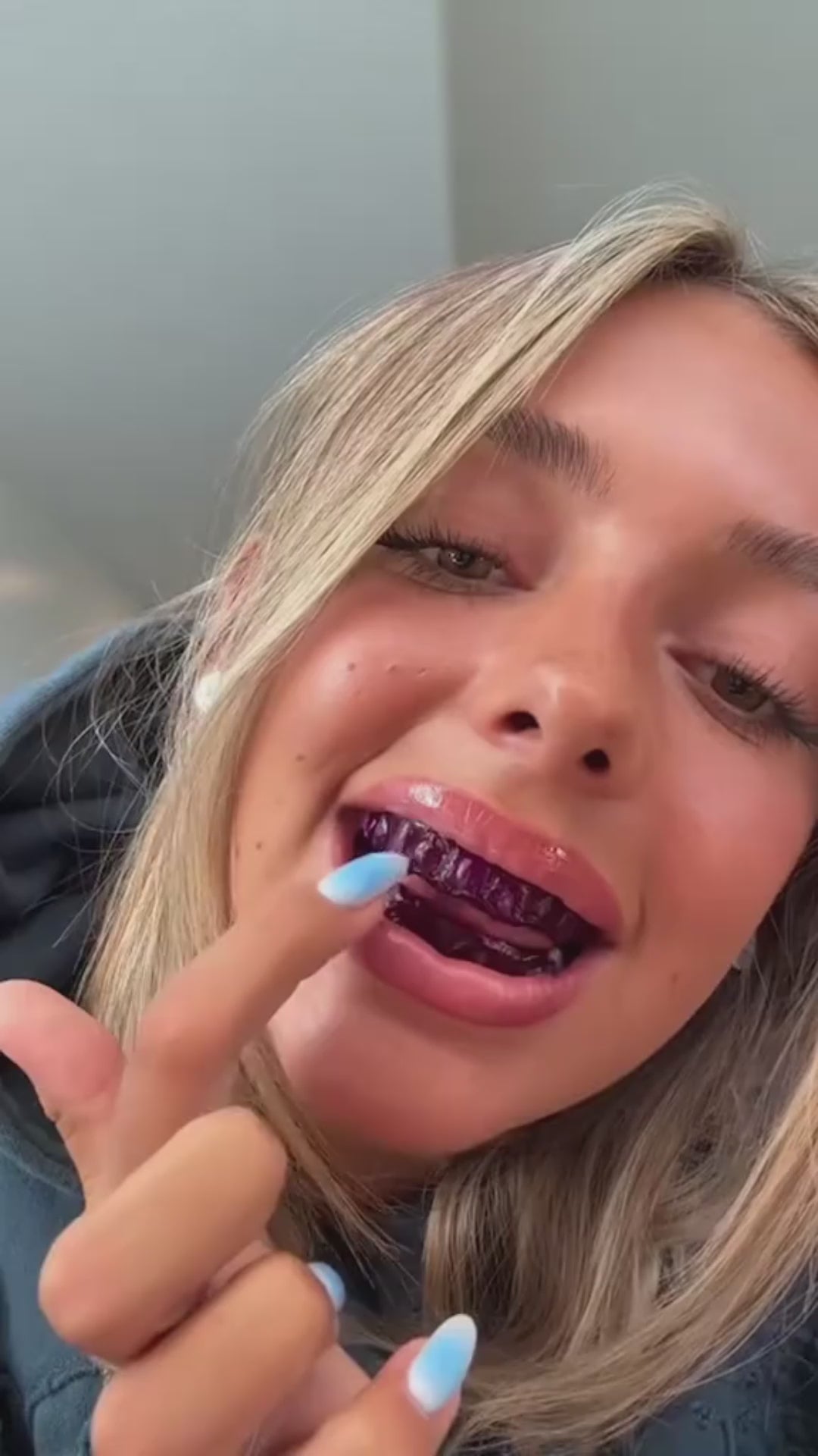 Whilux Whitening Strips™ video